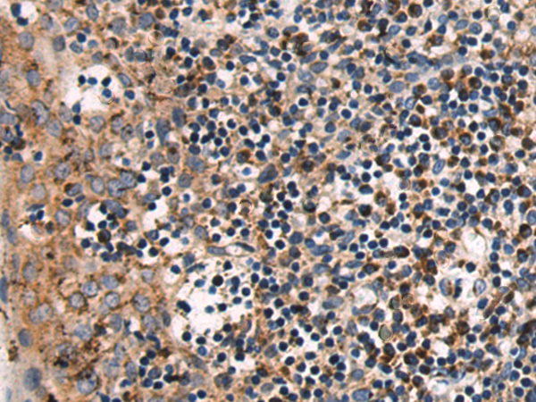 Rabbit Polyclonal Antibody to COPB2