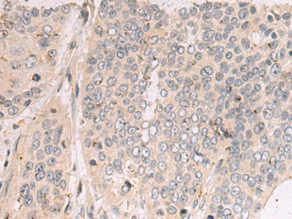 Rabbit Polyclonal Antibody to TDRD7