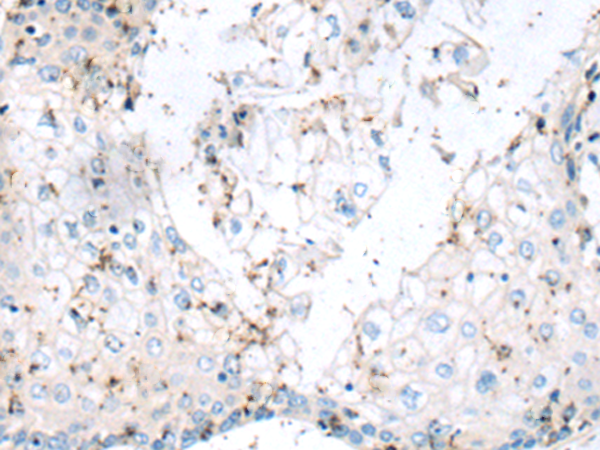 Rabbit Polyclonal Antibody to PPFIA1