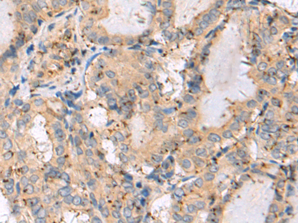 Rabbit Polyclonal Antibody to PFDN1