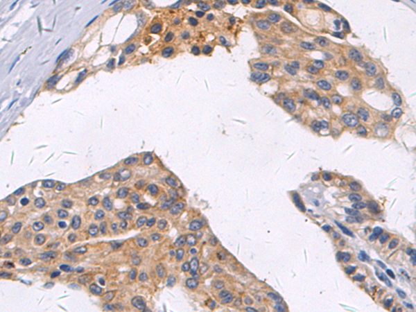 Rabbit Polyclonal Antibody to MYCBP