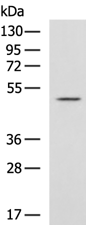 Rabbit Polyclonal Antibody to ATAT1