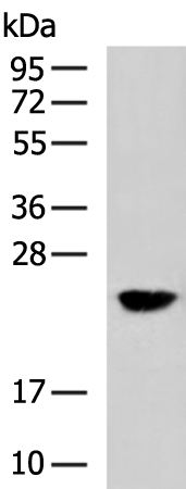 Rabbit Polyclonal Antibody to CIB2