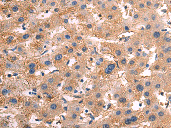 Rabbit Polyclonal Antibody to NRARP
