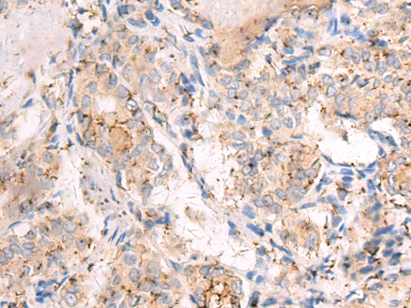 Rabbit Polyclonal Antibody to ARFIP2
