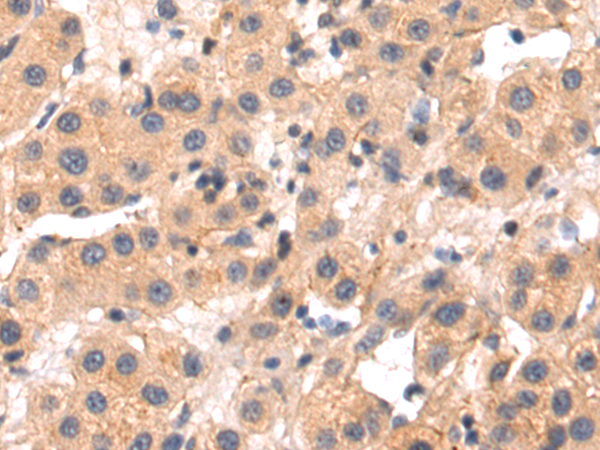 Rabbit Polyclonal Antibody to TMEM38B