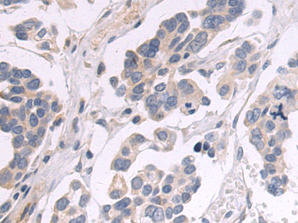 Rabbit Polyclonal Antibody to HKDC1