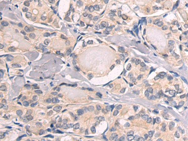 Rabbit Polyclonal Antibody to SH3GLB2