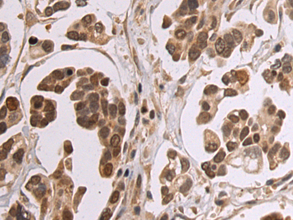 Rabbit Polyclonal Antibody to PHIP