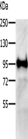 Rabbit Polyclonal Antibody to VCP