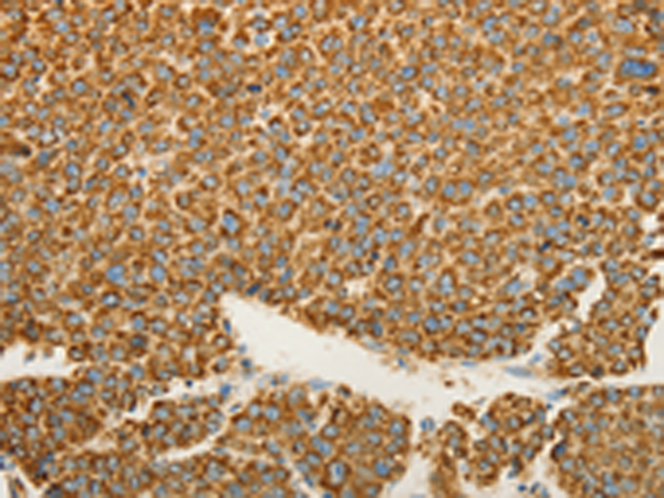 Rabbit Polyclonal Antibody to VDAC2