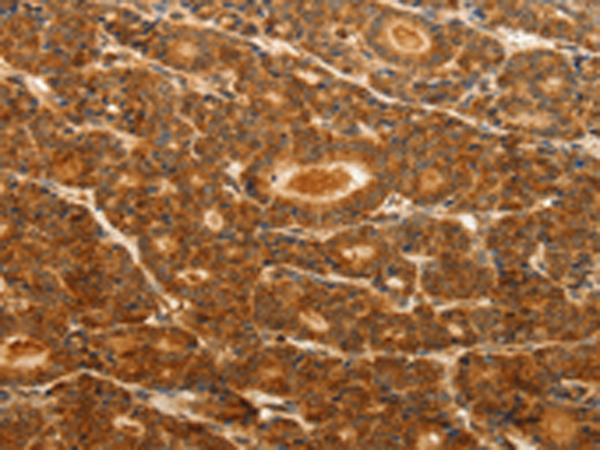 Rabbit Polyclonal Antibody to CDH5