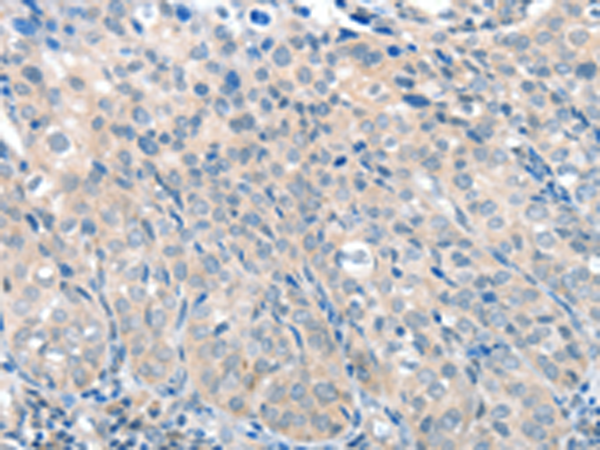 Rabbit Polyclonal Antibody to SLC17A6