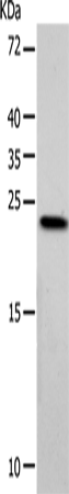 Rabbit Polyclonal Antibody to VSNL1