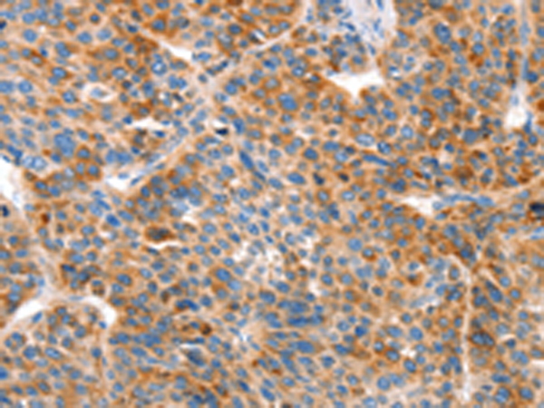 Rabbit Polyclonal Antibody to VTN