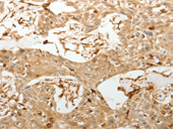 Rabbit Polyclonal Antibody to VMA21