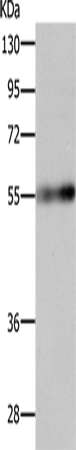 Rabbit Polyclonal Antibody to SLC18A2