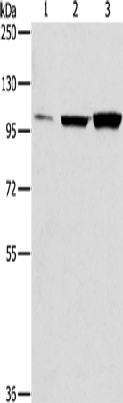 Rabbit Polyclonal Antibody to ZNF624