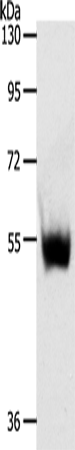 Rabbit Polyclonal Antibody to SLC30A6