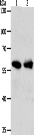 Rabbit Polyclonal Antibody to UNC5CL