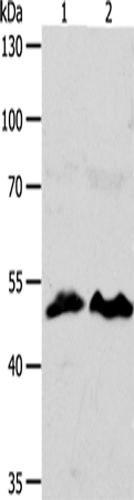 Rabbit Polyclonal Antibody to ZWILCH