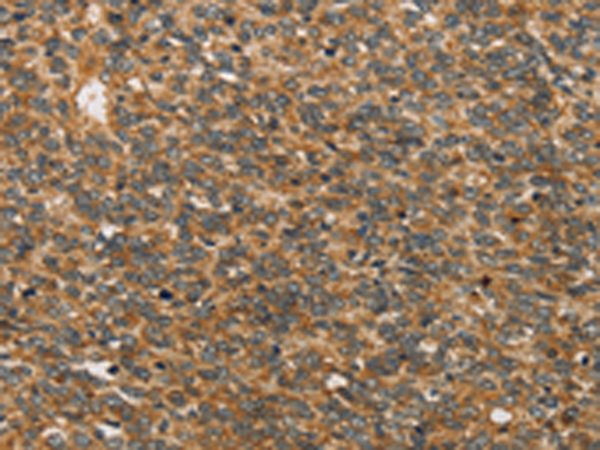 Rabbit Polyclonal Antibody to XPR1