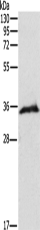 Rabbit Polyclonal Antibody to WBP2