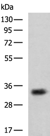 Rabbit Polyclonal Antibody to STUB1