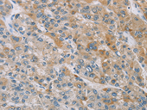 Rabbit Polyclonal Antibody to MAP3K20