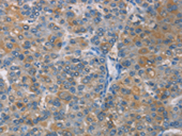 Rabbit Polyclonal Antibody to ZBTB1