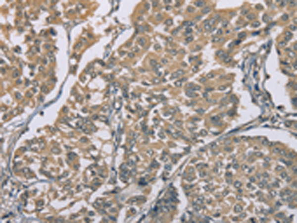 Rabbit Polyclonal Antibody to ZBTB2