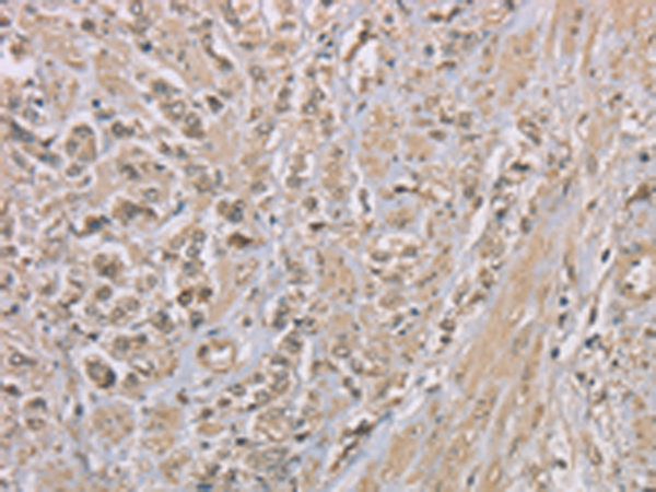 Rabbit Polyclonal Antibody to ZBTB2