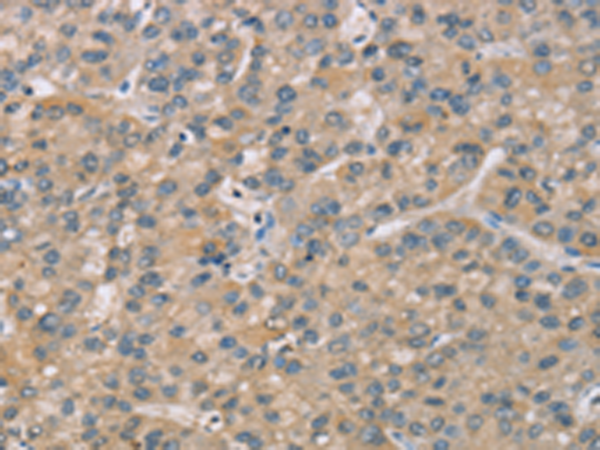 Rabbit Polyclonal Antibody to ZBTB3