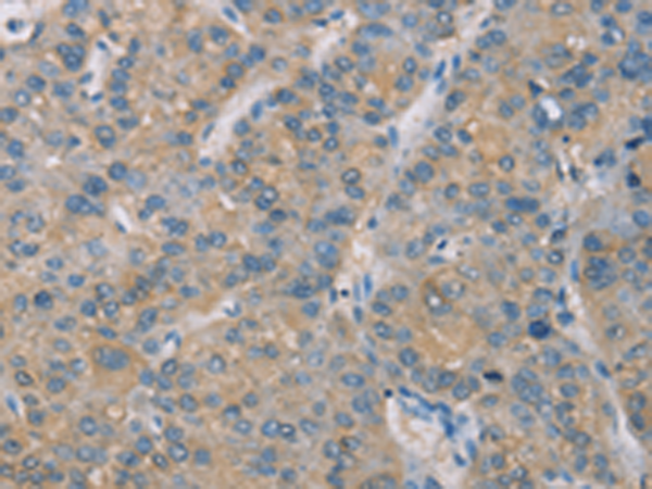 Rabbit Polyclonal Antibody to ZBTB6