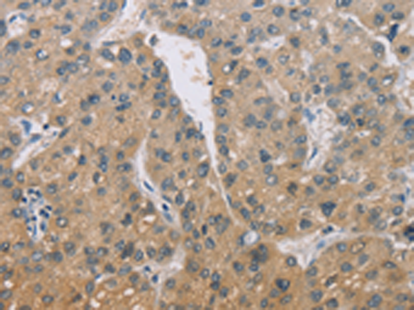 Rabbit Polyclonal Antibody to ZBTB6