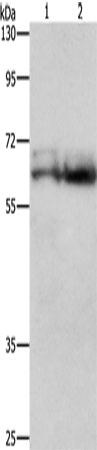Rabbit Polyclonal Antibody to ZDHHC17