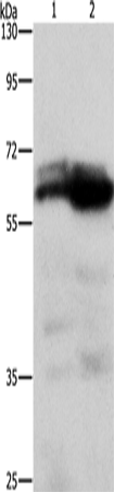 Rabbit Polyclonal Antibody to ZDHHC17
