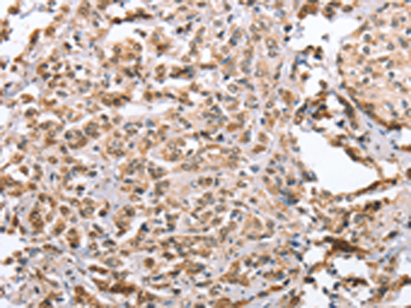 Rabbit Polyclonal Antibody to ZFYVE16