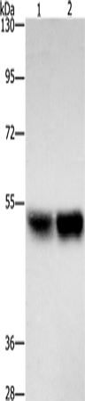 Rabbit Polyclonal Antibody to ZFYVE19