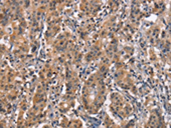 Rabbit Polyclonal Antibody to ZGPAT