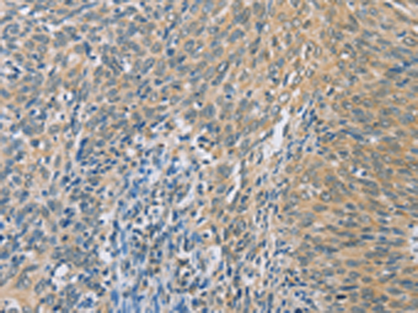 Rabbit Polyclonal Antibody to ZHX3