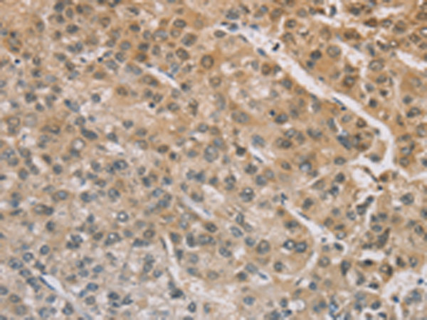 Rabbit Polyclonal Antibody to ZIC2