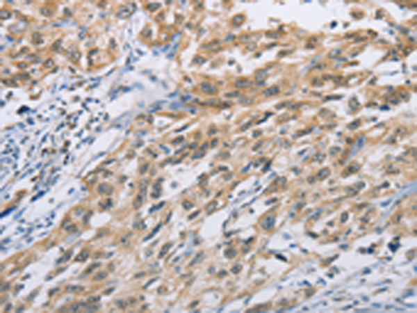 Rabbit Polyclonal Antibody to ZIC5