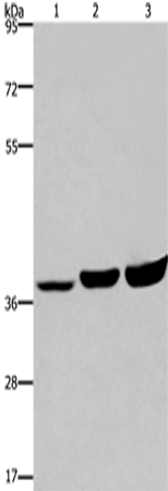 Rabbit Polyclonal Antibody to APAF1