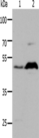 Rabbit Polyclonal Antibody to HTR1A