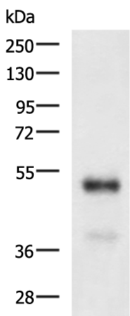 Rabbit Polyclonal Antibody to SERPINA3