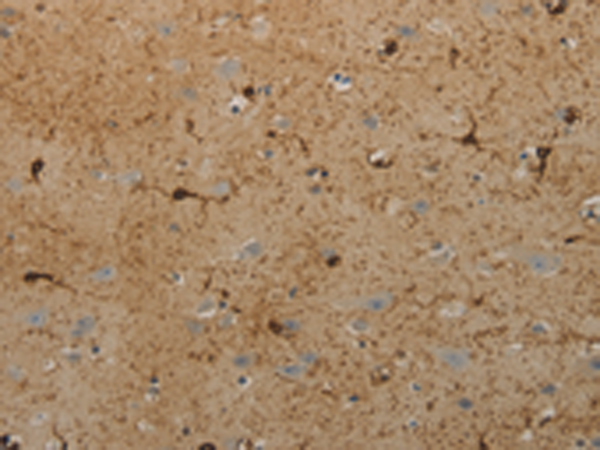 Rabbit Polyclonal Antibody to AATK