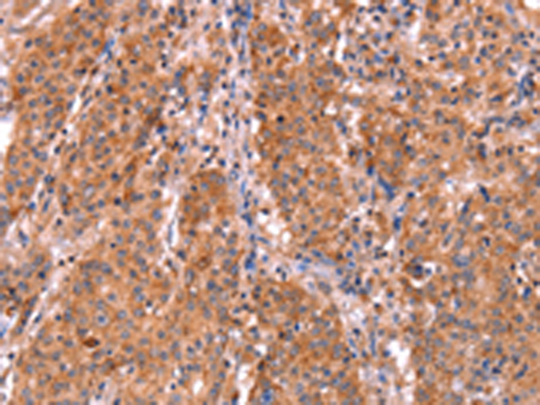 Rabbit Polyclonal Antibody to ABI1