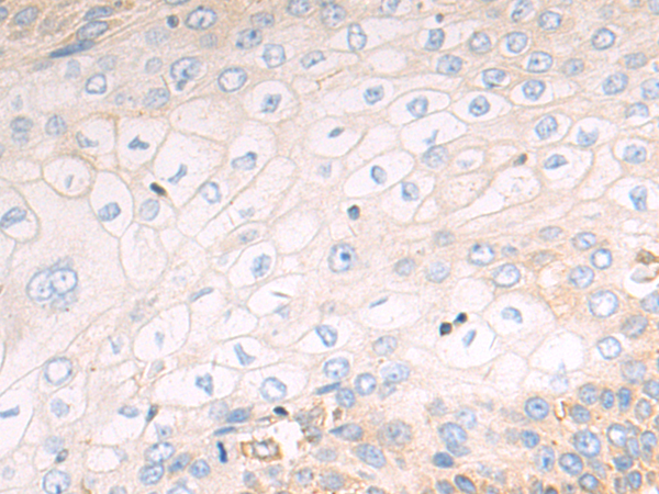 Rabbit Polyclonal Antibody to ACE2