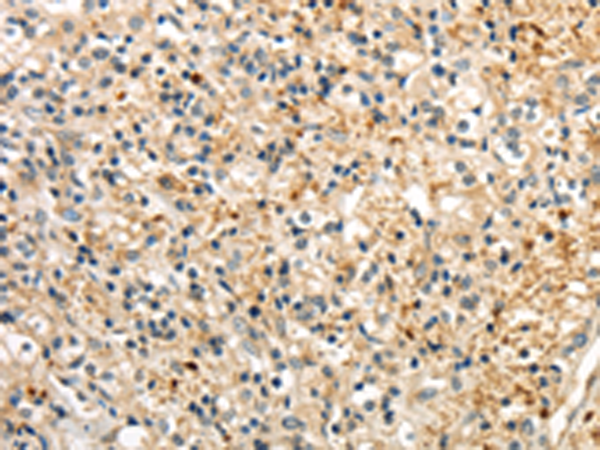 Rabbit Polyclonal Antibody to RAB17